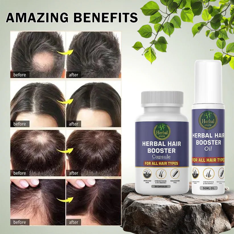 Combo of Herbal Hair Booster Oil and Capsule - For Men and Women - Herbal Cure