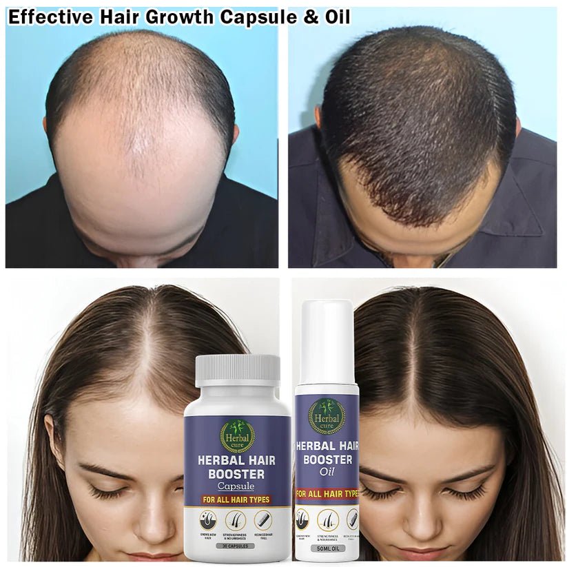 Combo of Herbal Hair Booster Oil and Capsule - For Men and Women - Herbal Cure
