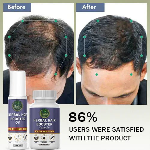 Combo of Herbal Hair Booster Oil and Capsule - For Men and Women - Herbal Cure