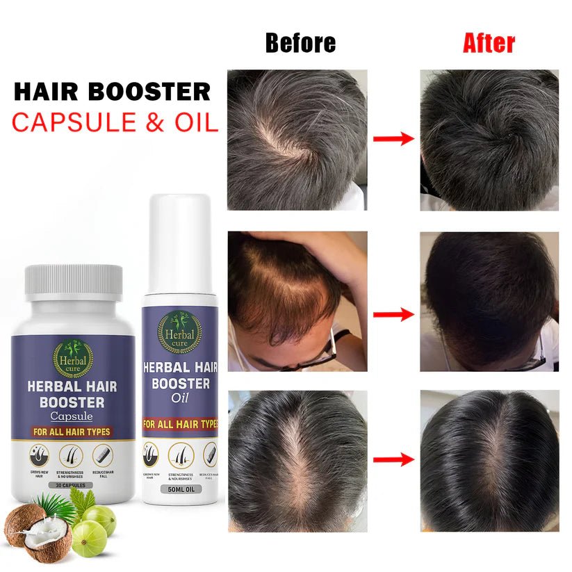 Combo of Herbal Hair Booster Oil and Capsule - For Men and Women - Herbal Cure